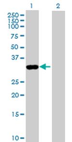 ANXA8 Antibody in Western Blot (WB)