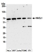 HACL1 Antibody in Western Blot (WB)