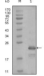 HAND1 Antibody in Western Blot (WB)