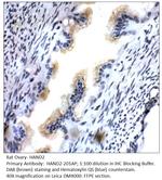 HAND2 Antibody in Immunohistochemistry (IHC)