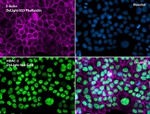 HDAC2 Antibody in Immunocytochemistry (ICC/IF)