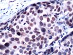 HDAC1 Antibody in Immunohistochemistry (Paraffin) (IHC (P))