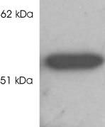 HDAC2 Antibody in Western Blot (WB)