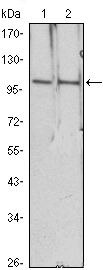 HDAC4 Antibody in Western Blot (WB)