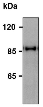 HELLS Antibody in Western Blot (WB)