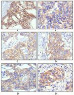 ErbB2 (HER-2) Antibody in Immunohistochemistry (Paraffin) (IHC (P))