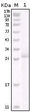 ErbB2 (HER-2) Antibody in Western Blot (WB)