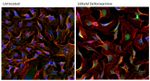 HIF1A Antibody in Immunocytochemistry (ICC/IF)