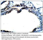 HIF-1-Alpha isoform 1 Antibody in Immunohistochemistry (IHC)