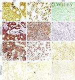 EBP50 Antibody in Immunohistochemistry (Paraffin) (IHC (P))