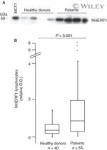 EBP50 Antibody in Western Blot (WB)