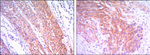 HK2 Antibody in Immunohistochemistry (Paraffin) (IHC (P))