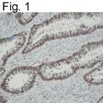 hnRNP K Antibody in Immunohistochemistry (IHC)