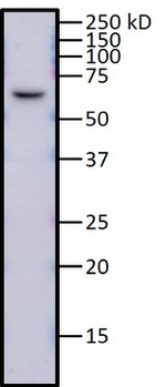 hnRNP K Antibody in Western Blot (WB)