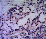 HSPA4 Antibody in Immunohistochemistry (Paraffin) (IHC (P))