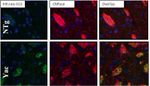 Huntingtin Antibody in Immunohistochemistry (IHC)