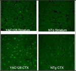 Huntingtin Antibody in Immunohistochemistry (IHC)