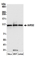 IARS2 Antibody in Western Blot (WB)