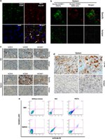 ICAM-1 Antibody in Immunohistochemistry (IHC)