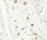 Chk1 Antibody in Immunohistochemistry (Paraffin) (IHC (P))