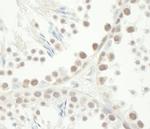 Chk1 Antibody in Immunohistochemistry (Paraffin) (IHC (P))