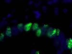 PCNA Antibody in Immunohistochemistry (Paraffin) (IHC (P))