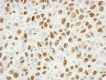 PCNA Antibody in Immunohistochemistry (Paraffin) (IHC (P))