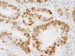 PCNA Antibody in Immunohistochemistry (Paraffin) (IHC (P))