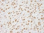 SMC1 Antibody in Immunohistochemistry (Paraffin) (IHC (P))