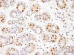 SMC1 Antibody in Immunohistochemistry (Paraffin) (IHC (P))