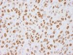 USP7 Antibody in Immunohistochemistry (Paraffin) (IHC (P))