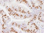 USP7 Antibody in Immunohistochemistry (Paraffin) (IHC (P))