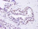 BRD8 Antibody in Immunohistochemistry (Paraffin) (IHC (P))