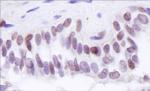 BRD8 Antibody in Immunohistochemistry (Paraffin) (IHC (P))