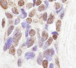 CoAA Antibody in Immunohistochemistry (Paraffin) (IHC (P))