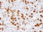 p300 Antibody in Immunohistochemistry (Paraffin) (IHC (P))