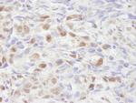 NCOA2/SRC2 Antibody in Immunohistochemistry (Paraffin) (IHC (P))