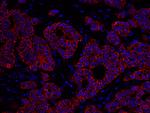 ErbB2 Antibody in Immunohistochemistry (Paraffin) (IHC (P))