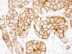 ErbB2 Antibody in Immunohistochemistry (Paraffin) (IHC (P))