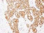 ErbB2 Antibody in Immunohistochemistry (Paraffin) (IHC (P))