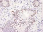 CDK11 Antibody in Immunohistochemistry (Paraffin) (IHC (P))