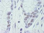 CDK11 Antibody in Immunohistochemistry (Paraffin) (IHC (P))