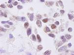 CKII alpha Antibody in Immunohistochemistry (Paraffin) (IHC (P))