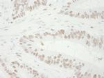 MCM3 Antibody in Immunohistochemistry (Paraffin) (IHC (P))