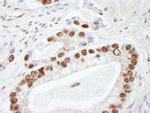 DNA-PKcs Antibody in Immunohistochemistry (Paraffin) (IHC (P))