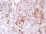 CARM1 Antibody in Immunohistochemistry (Paraffin) (IHC (P))