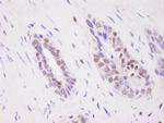 CARM1 Antibody in Immunohistochemistry (Paraffin) (IHC (P))