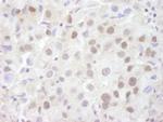 REA Antibody in Immunohistochemistry (Paraffin) (IHC (P))