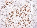 HDAC2 Antibody in Immunohistochemistry (Paraffin) (IHC (P))