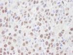 HDAC2 Antibody in Immunohistochemistry (Paraffin) (IHC (P))